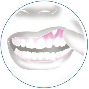 vectans_visuel_bouche2